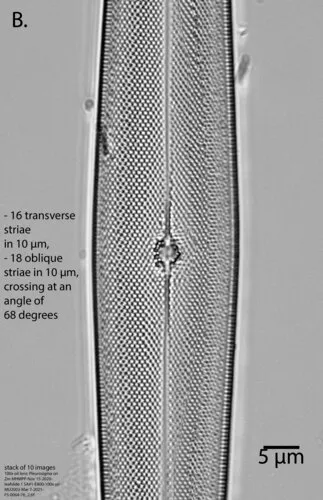 Pleurosigma intermedium