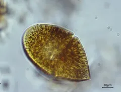 Gymnodinium fuscum thumbnail 3