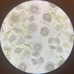 Anthoceros fusiformis thumbnail 2