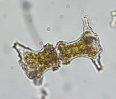 Staurastrum elongatum thumbnail 2