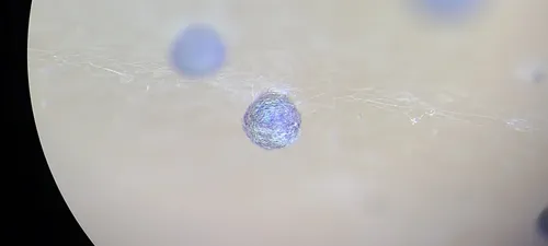 Diacheopsis vermicularis