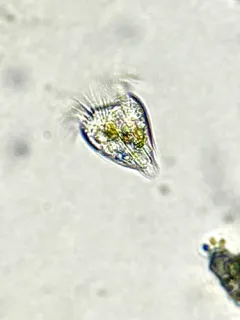 Strobilidium caudatum thumbnail 2