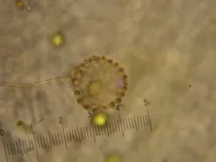 Clathrulina elegans thumbnail 4