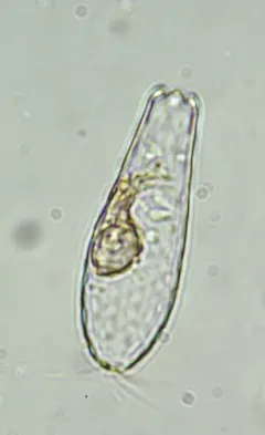 Euglypha cristata thumbnail 4
