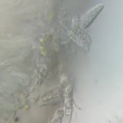Six-celled Moss Dot Lichen thumbnail 4