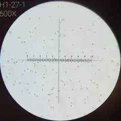 Rhizopogon parksii thumbnail 4