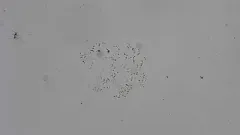 Chaetoceros socialis thumbnail 4