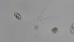 Chaetoceros didymus thumbnail 2