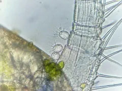 Tokophrya cyclopum thumbnail 2
