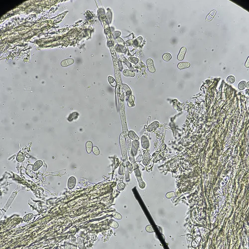 Hypomyces mycophilus