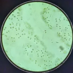 Tetraspora gelatinosa thumbnail 2