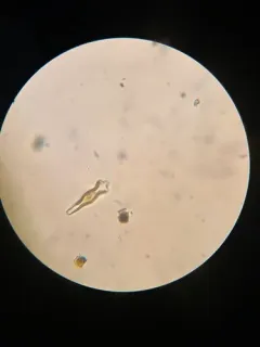 Gomphonema acuminatum thumbnail 1