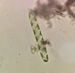Spirotaenia condensata thumbnail 4