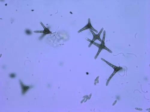 Actinocladium rhodosporum