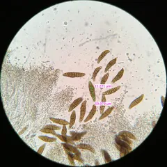 Hysterographium flexuosum thumbnail 2