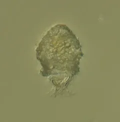 Codonella cratera thumbnail 2