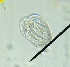 Phacodinium metchnikoffi thumbnail 3