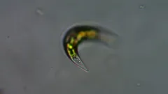 Closterium incurvum thumbnail 1