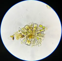Meridion constrictum thumbnail 3