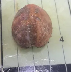 Brisaster fragilis thumbnail 1