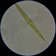 Closterium setaceum thumbnail 3
