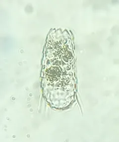 Euglypha acanthophora thumbnail 2