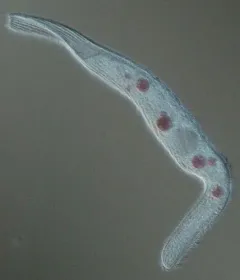 Spirostomum teres thumbnail 4