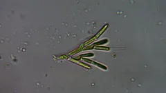 Microthamnion kuetzingianum thumbnail 1