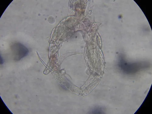 Aglaodiaptomus spatulocrenatus