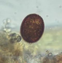 Trachelomonas hispida thumbnail 4