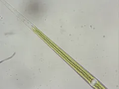 Closterium aciculare thumbnail 4