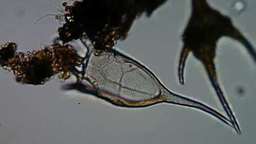 Keratella cochlearis