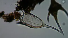 Keratella cochlearis thumbnail 1
