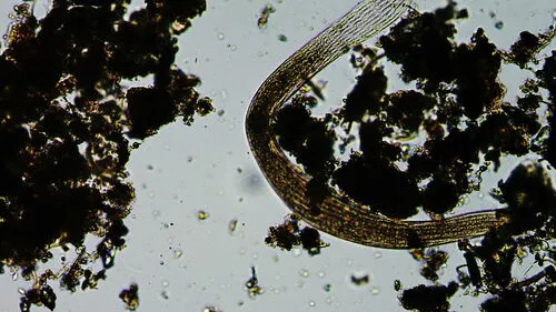 Spirostomum teres