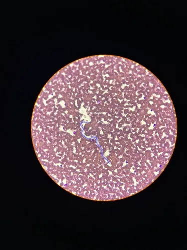 Dog Heartworm