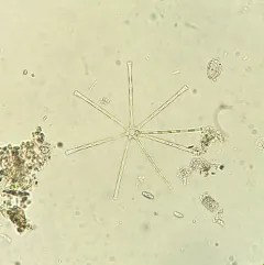 Asterionella formosa thumbnail 4