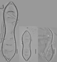 Surirella librile thumbnail 3