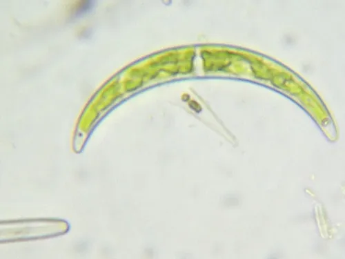 Closterium venus