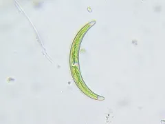 Closterium incurvum thumbnail 2