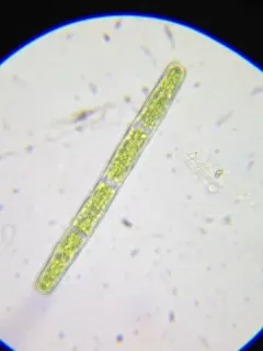 Penium margaritaceum thumbnail 2