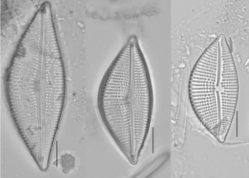 Encyonema triangulum