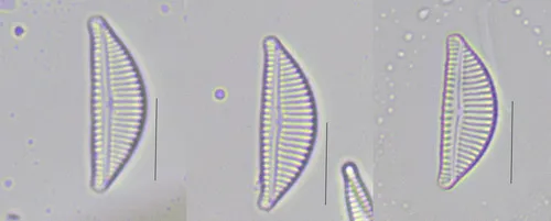 Encyonema lange-bertalotii