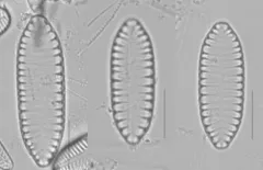 Surirella angusta thumbnail 2