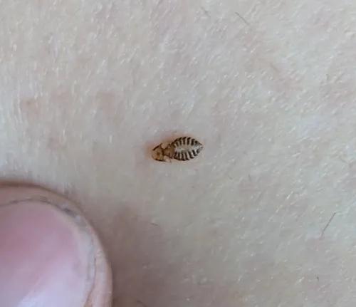 Large Turkey Louse
