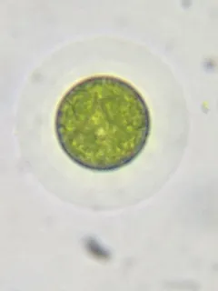 Planktosphaeria gelatinosa thumbnail 2