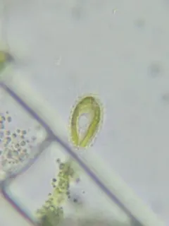 Mallomonas caudata thumbnail 3