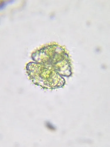 Staurastrum scabrum