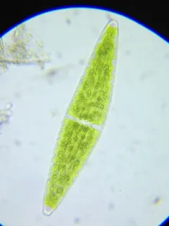 Closterium lunula thumbnail 4