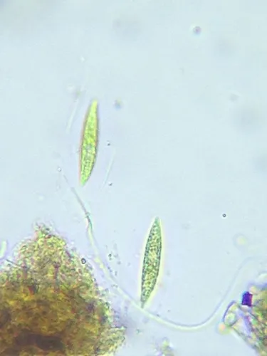 Elakatothrix gelatinosa