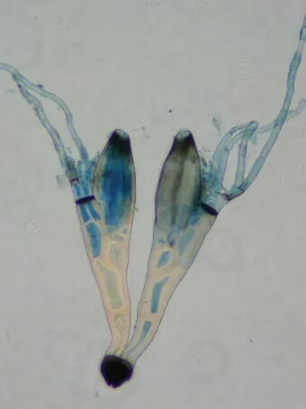 Laboulbenia clivinalis